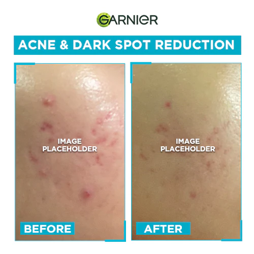 GARNIER BRIGHT COMPLETE ANTI-ACNE BOOSTER SERUM 15ML - Image 5