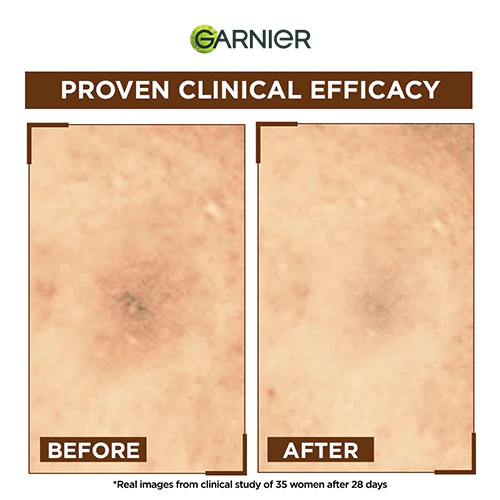 GARNIER BRIGHT COMPLETE OVERNIGHT BOOSTER SERUM 15ML - Image 3