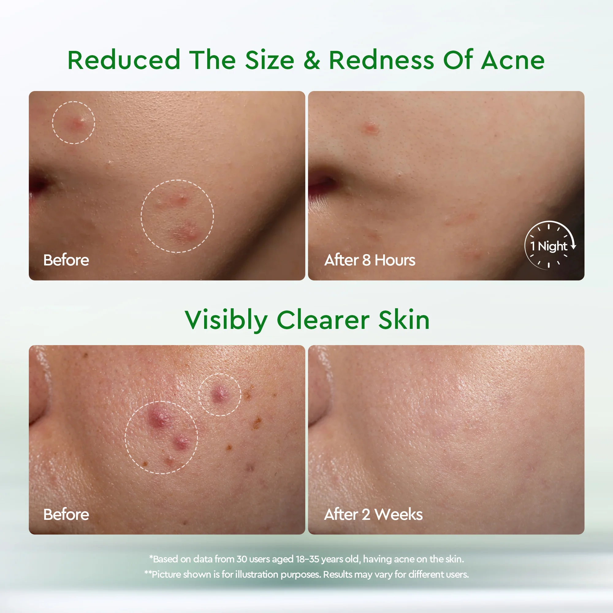 GLAD2GLOW ACNE DRYING LOTION 10ML - Image 7