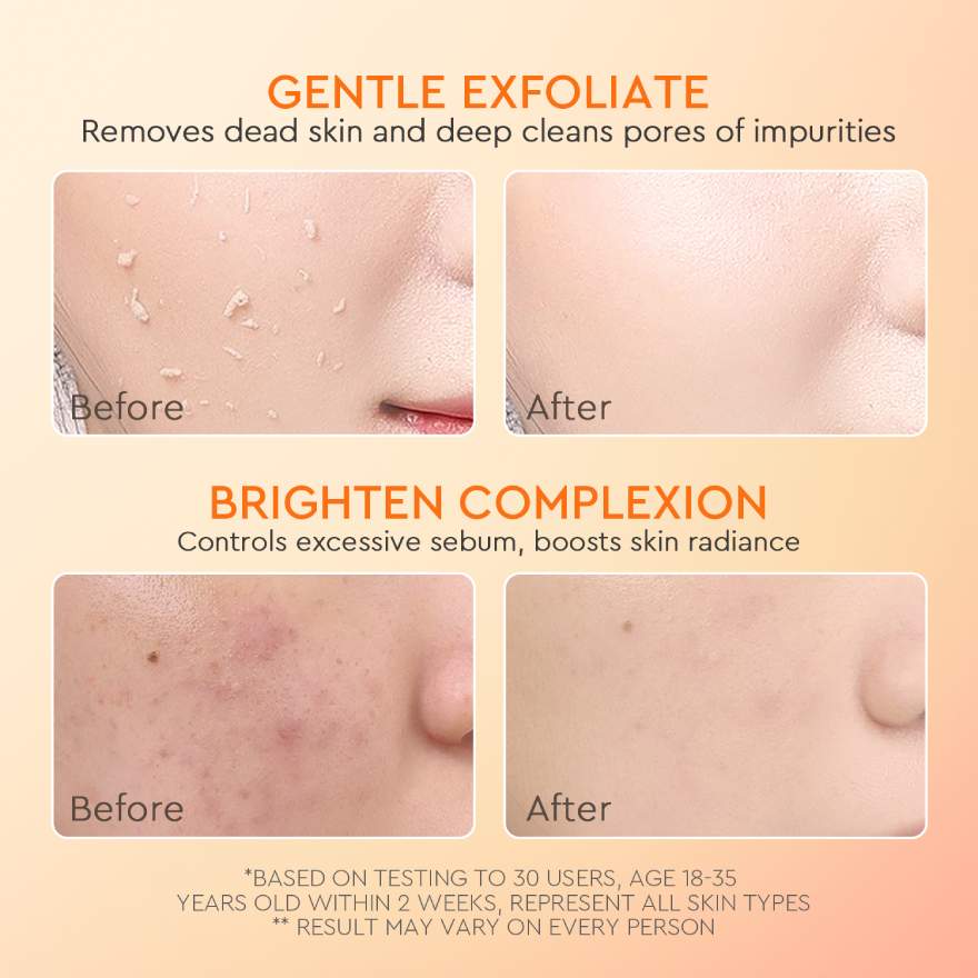 GLAD2GLOW APRICOT GLYCOLIC ACID EXFO SMOOTH PEELING GEL 50G - Image 5