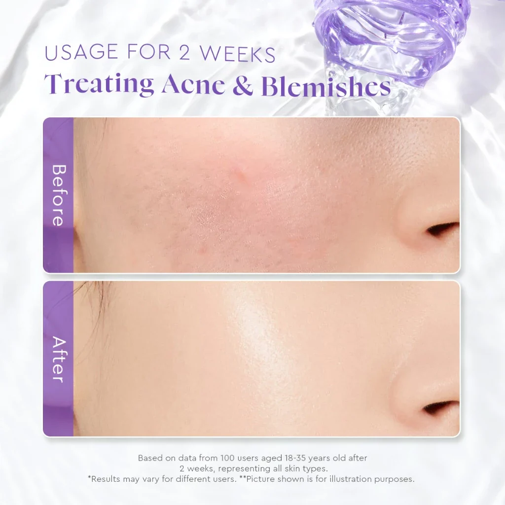 GLAD2GLOW BLACKBERRY AHA BHA PHA EXFOLIATING TONER 80ML - Image 5