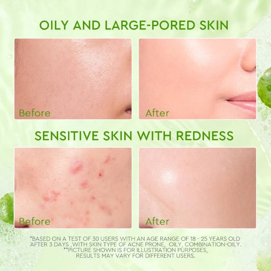 GLAD2GLOW CENTELLA SALICYLIC ACID ACNE GEL CLEANSER 70ML - Image 5