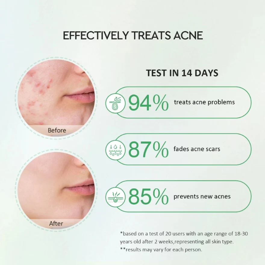 GLAD2GLOW CENTELLA SALICYLIC ACID POWER ACNE SERUM 17ML - Image 4