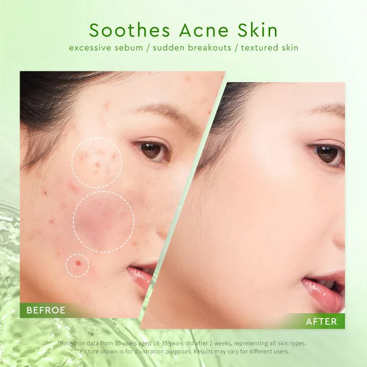 GLAD2GLOW MUGWORT ACNE GEL MASK 50G - Image 4